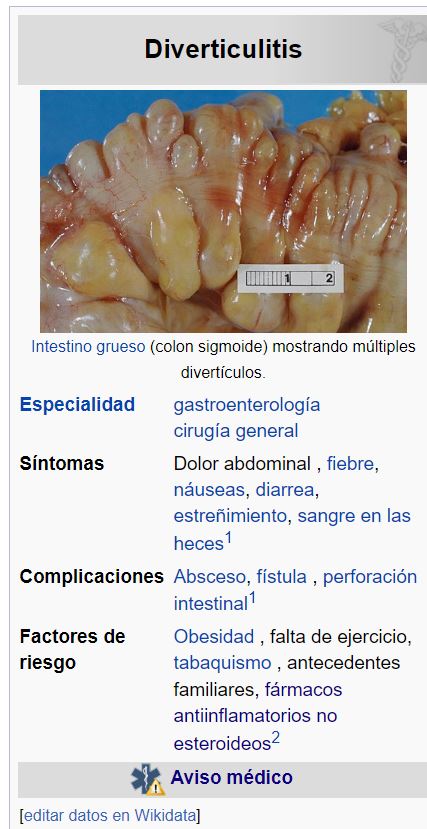 diverticulitis.JPG